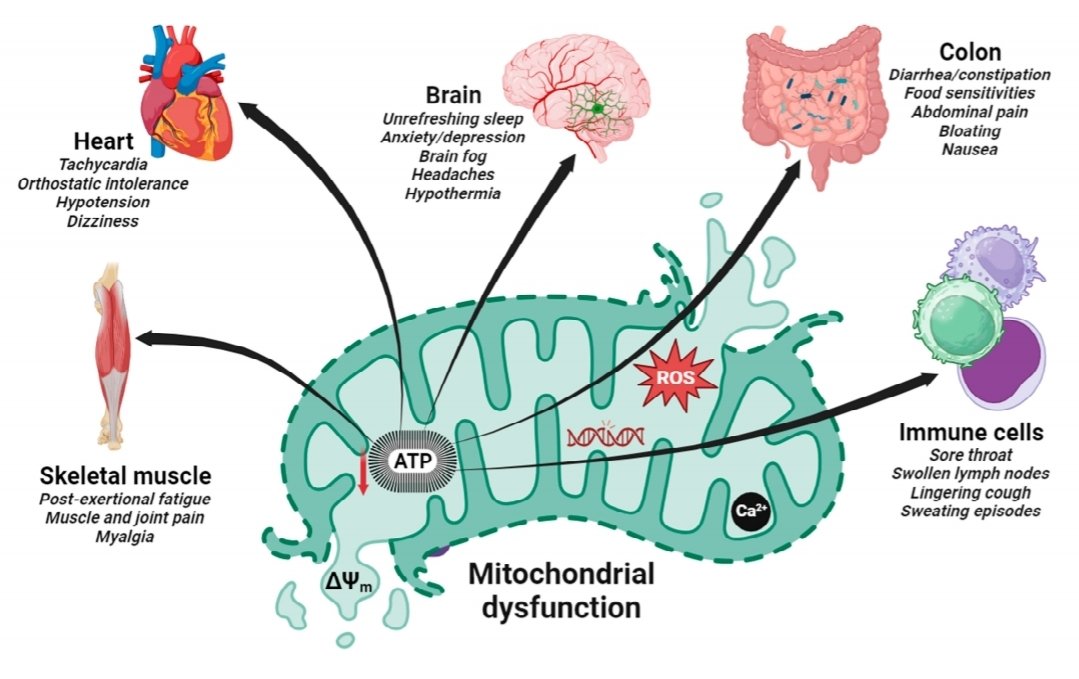 Mitochondrial Dysfunction (MD) & Coenzyme Q10 Suppl in Post-Viral Fatigue Syndrome PVFS: disabling fatigue, myalgia & joint pain, cognitive impairments, unrefreshing sleep, autonomic dysfunction & psychiatric symptoms CoQ10 suppl may ameliorate MD & PVFS mdpi.com/1422-0067/25/1…