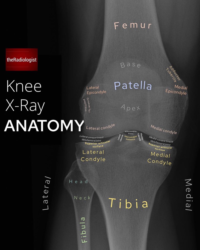 Knee X-Ray Anatomy