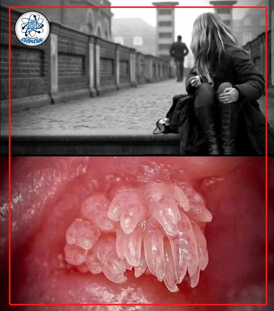 EnsedeCiencia's tweet photo. “El amor se va, pero el VPH se queda”, palabras de mi profe de microbiología, para nunca olvidar 😨👇 https://t.co/jtNzoKJ4Vq