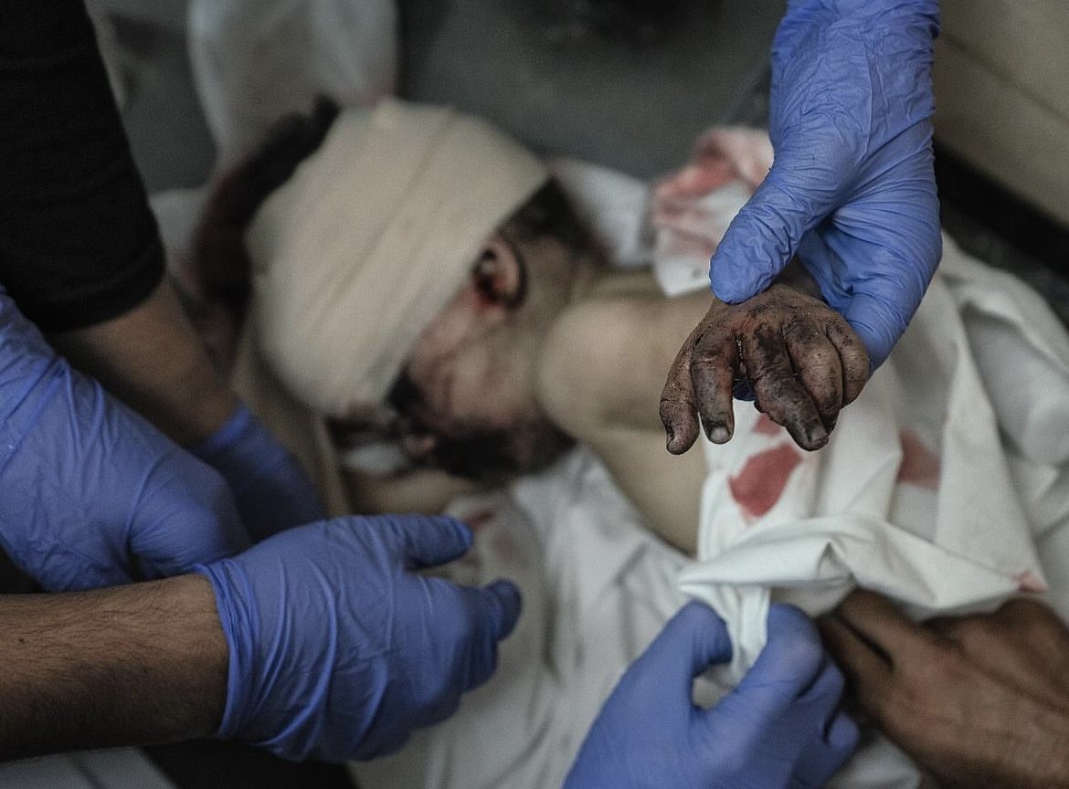 Inside the ICU, too crowded and dirty to be called an ICU. Due to big numbers of injuries that arrive to the hospital after each Israeli air strike, there is no space for anyone even the medical team. With a big shortage in equipments, medical supplies and tools. A lot of…