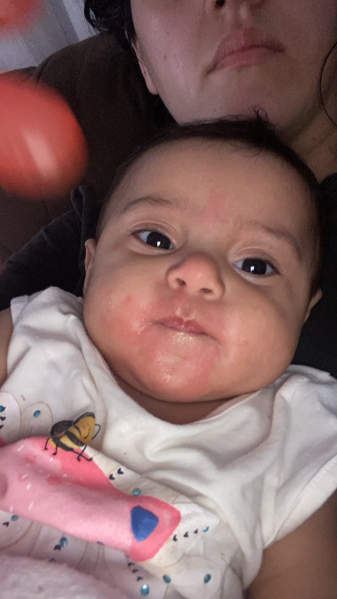 SarahASLima's tweet photo. Hadassa é alérgica a ovo! Meu coração começou a gela e o que fazer ?!
Ainda bem que teve uma farmácia aberta e consegui um antialérgico 😭 https://t.co/TNQ2GD0PCs