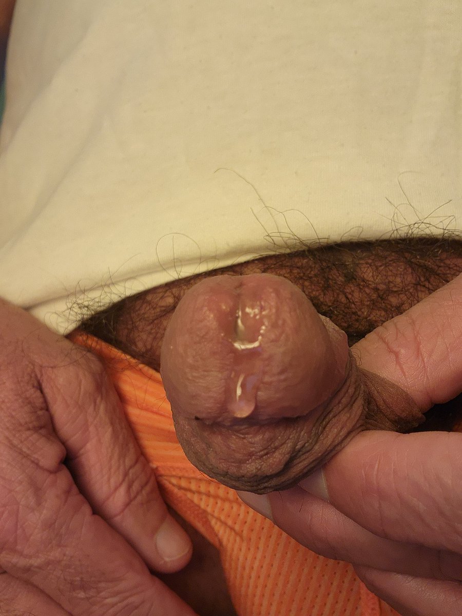 AcumLovinGuy's tweet photo. Wokeup like this : #dickleaking #daddyhole #fatass #leakingprecum
#LAbottom #menssexyunderwear #menswaxing #smoothasshole #hole #bigballs #precumming
#gayasshole #silverdaddy #smoothballs #bigballs #manhole #LAfreaks #smoothmanhole #smoothfuckhole #oozingprecum #precumdripping https://t.co/LC0fA2ds7U