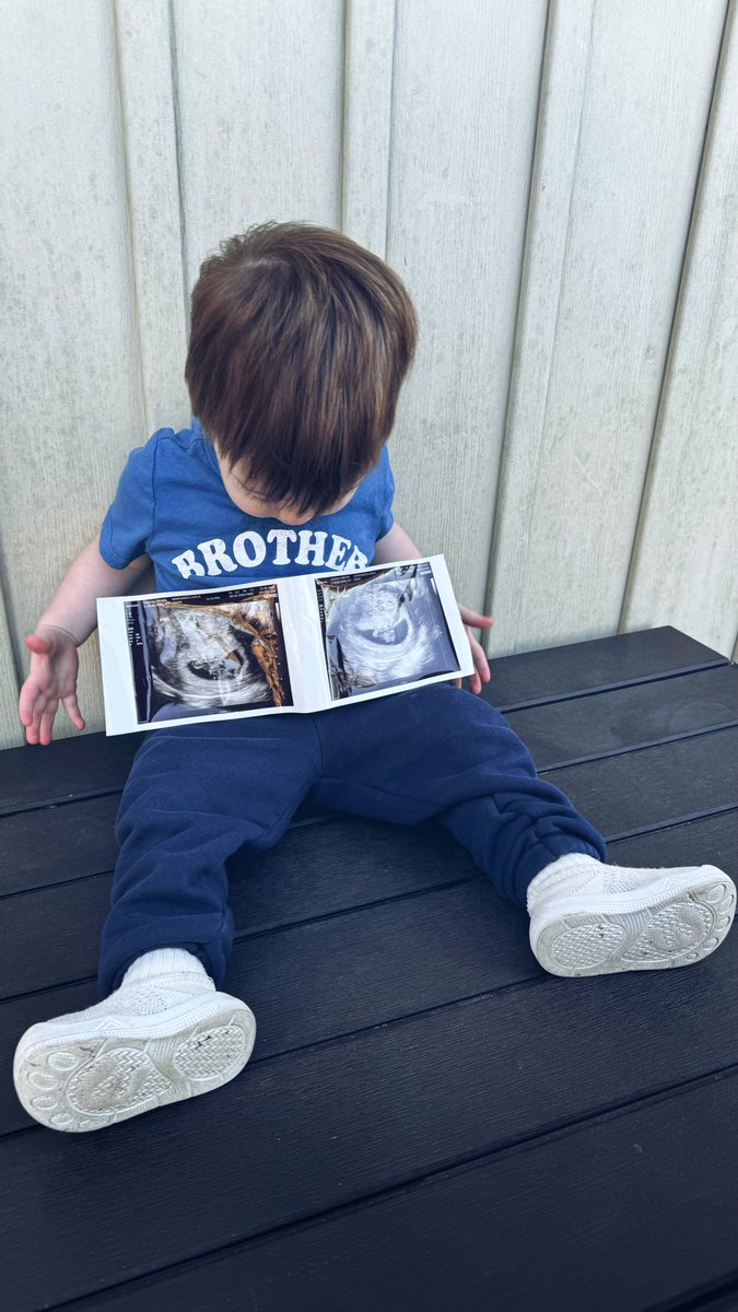 Oliver is being upgraded to BIG BROTHER 🤩