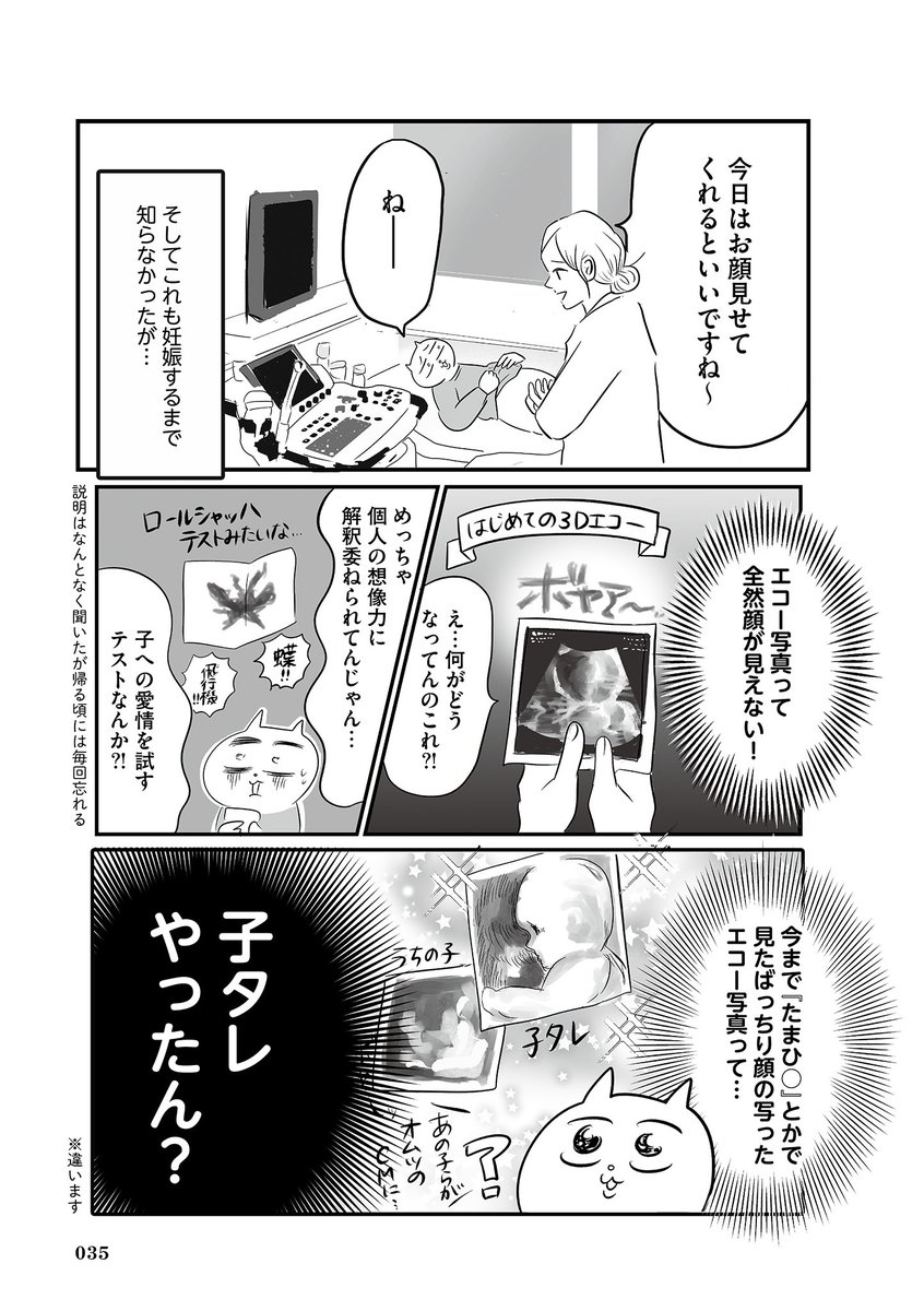 出産が思ってたんと違いすぎた(3/8) #漫画が読めるハッシュタグ