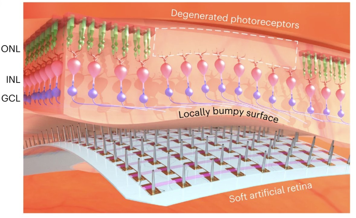 NikoMcCarty's tweet photo. Five biotechnology papers published in the last two days.

1. An artificial retina restores object recognition in mice.

Made from an array of printed microelectrodes, the device was implanted into mice. Shining light onto a fully deteriorated retina triggered a neural response. https://t.co/Bu2eziIHbs
