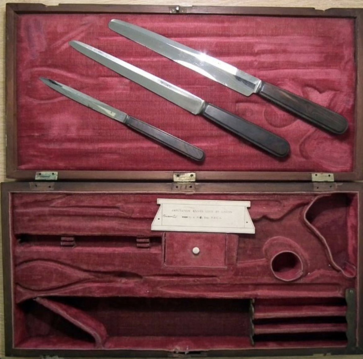 The amputation instruments used by the the infamous surgeon Robert Liston between 1815 and 1825. 

In the 1800s, Scottish surgeon Robert Liston became infamous for a surgery that led to an astonishing 300% mortality rate. 

He amputated a patient's leg in under 2.5 minutes,…