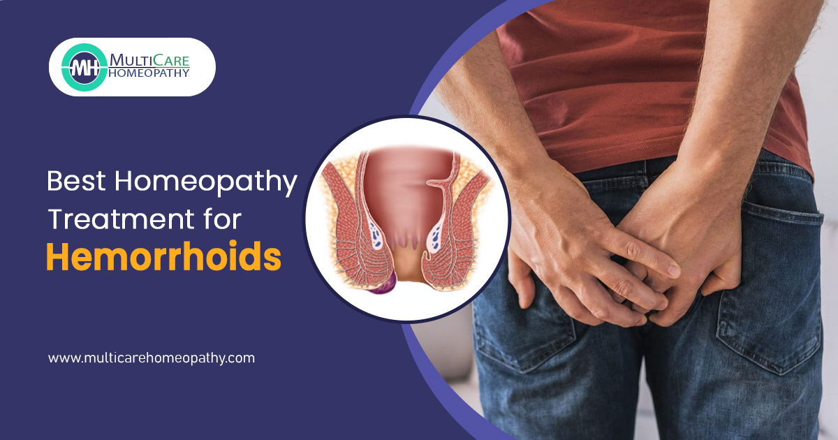 Managing Piles Naturally: Can Hemorrhoids Resolve Without Surgery?

Homeopathy medicine and treatment is an effective and safe way to seek treatment for piles. Such medicines have no side effects and don’t cause any harm to your body. 

#pilestreatment