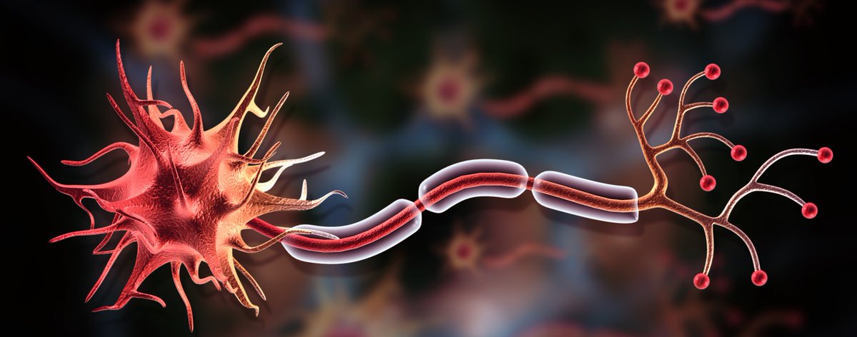 We looked at PIRA – the idea that MS-related disability is the result of nerve damage that is occurring even in people who are experiencing no relapses. 

Part 3: msology.ca/ms-the-coming-…

#MSResearch #MSTreatments #multiplesclerosis #livingwithMS #MS #treatingMS #MScure