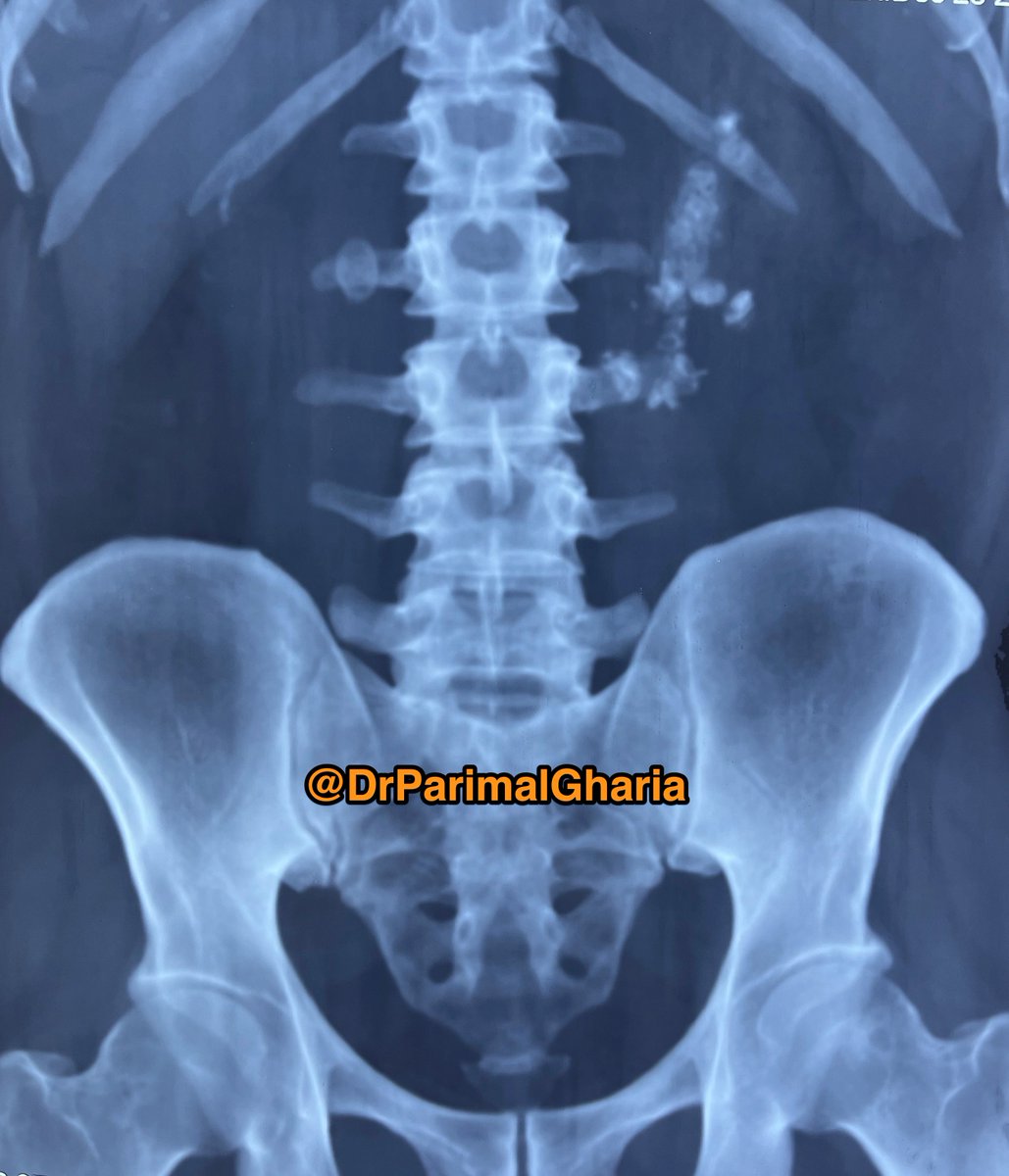 Dr Parimal Gharia tweet media