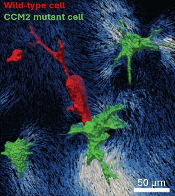 ❗️Do cellular forces contribute to vascular lesion growth?❗️

👩‍🔬Using a model of angiogenic invasion compatible with 3D traction force microscopy

💡We show mutant cells exert high forces to recruit wild-type cells in 🧠cerebral cavernous malformations. biorxiv.org/content/10.110…