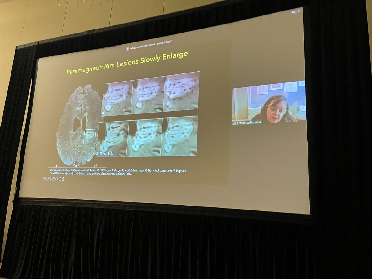 Paramagnetic rim lesions (PRL) = chronic active lesions.  Critical to #MS progression &amp; lesion growth…and needing a next-gen #DMT to zap that inflammation.

Can we stratify for this riskier #MS pt population?

Dr. Francesca Bagnato makes that challenge!

@VUMCneurology 
#AM2024
