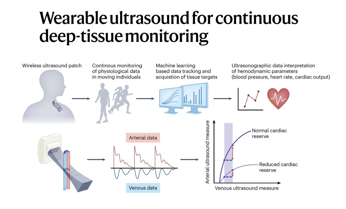 Eric Topol (@erictopol) on Twitter photo The ability to do continuous, high-resolution ultrasound imaging of an organ in people on the go through a wearable patch is an important innovation
nature.com/articles/s4158… <a href="/NatureBiotech/">Nature Biotechnology</a> <a href="/heart_lung/">Jon-Emile Kenny</a> The ability to do continuous, high-resolution ultrasound imaging of an organ in people on the go through a wearable patch is an important innovation
nature.com/articles/s4158… <a href="/NatureBiotech/">Nature Biotechnology</a> <a href="/heart_lung/">Jon-Emile Kenny</a>