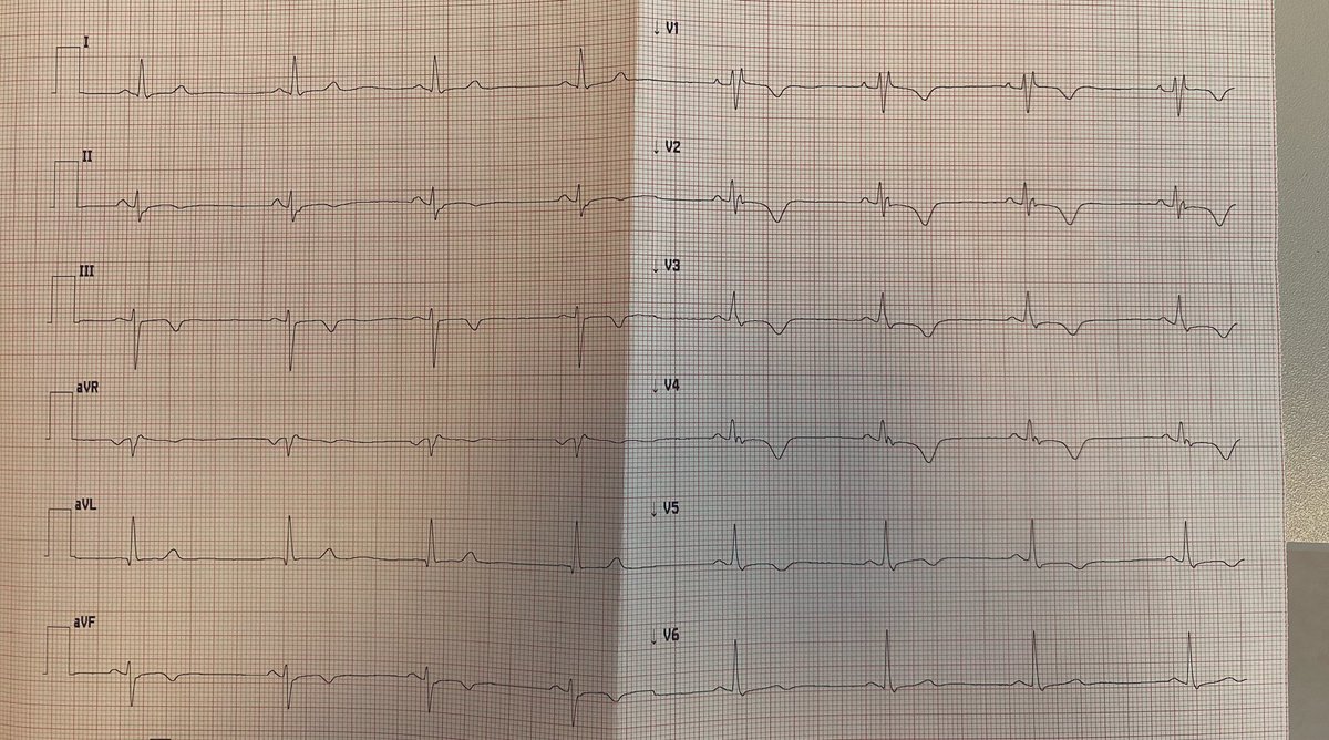 lukasz_zydzik's tweet photo. What are the problems here ?
One echo - 2 diagnosis 😏
#echofirst #CardioTwitter https://t.co/aixtmOye9w