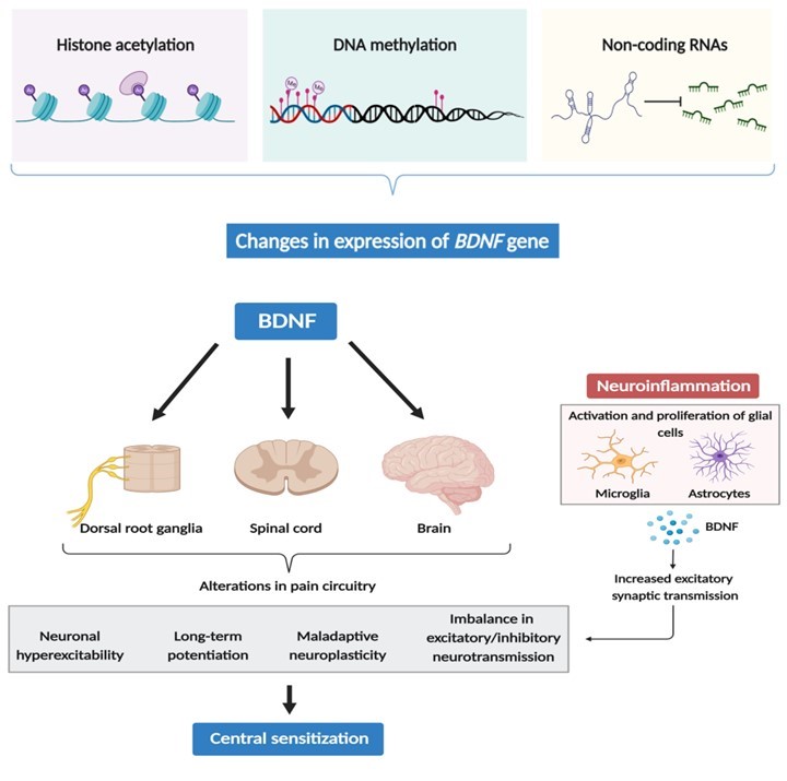 JoNijsBE's tweet image. Dear X Friends, while our 2015 review on Brain-Derived Neurotrophic Factor in chronic #pain relied heavily on preclinical work  doi.org/10.1517/147282…, clinical studies inspired a 2024 update, ft. links to #neuroinflammation &amp;amp; central #sensitization: doi.org/10.3390/biom14… 🔓