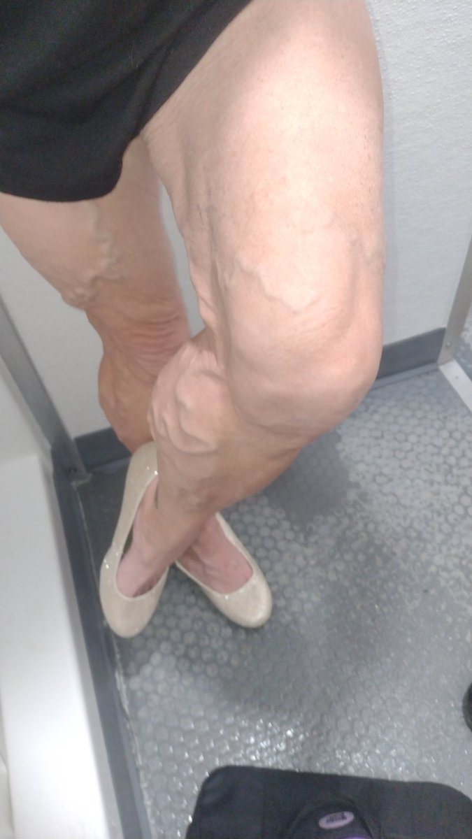 TempestJones79's tweet photo. Glitter heels and calves https://t.co/nxWiG2sZaC #leglady #veins #tempestjones4life https://t.co/Sm7O6DWdNd