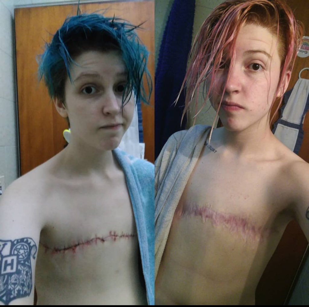 ThePosieParker's tweet photo. The young woman in the first picture has tweeted the second picture to show she’s doing really well these days. https://t.co/RkZYGMx7EK