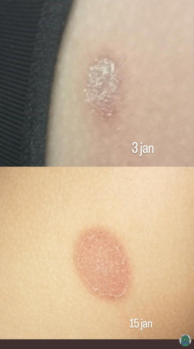 Tanyarlfes tweet media