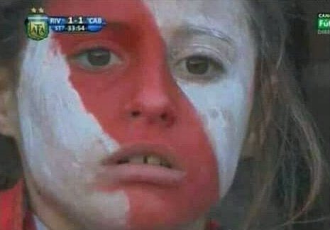 COMO QUE EL PITY MARTINEZ SE ROMPIO LOS CRUZADOS
