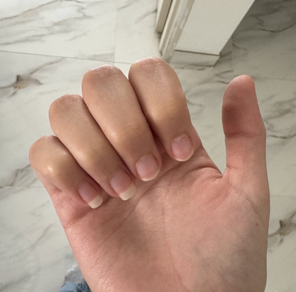 favari3s's tweet photo. another episode of bulimic or lesbian https://t.co/NshymgdiPa
