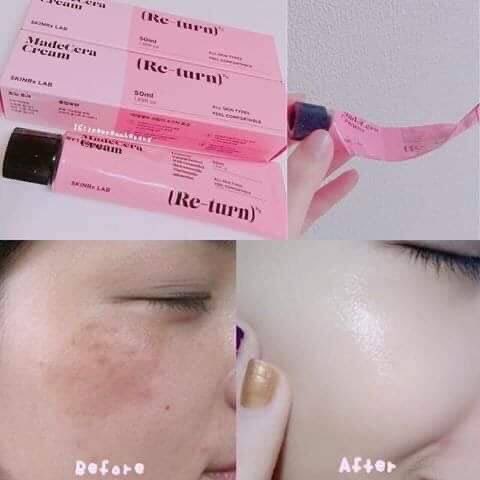 Akiwa01_mi's tweet photo. #พร้อมส่ง Skinrx Lab Madecera Re-turn Cream
ช่วยให้ผิวจุดด่างดำลดลง ลดสิว กระฝ้าลดลง ปกป้องผิวจากความร้อน และช่วยทำให้ผิวแข็งแรง
💗15ml = 230
💗50ml = 460 ❌หมด❌
#สกินแคร์ #ครีมรีเทิร์น #สกินแคร์เกาหลี #skinrxlab #returncream #ลดรอยสิว https://t.co/cL8EgNu0j4