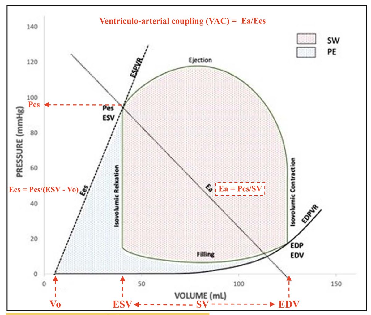 ICU Hemodynamics: The weekly reminder of the left ventricular (LV) pressure-volume loop and the concept of ventriculo-arterial coupling: