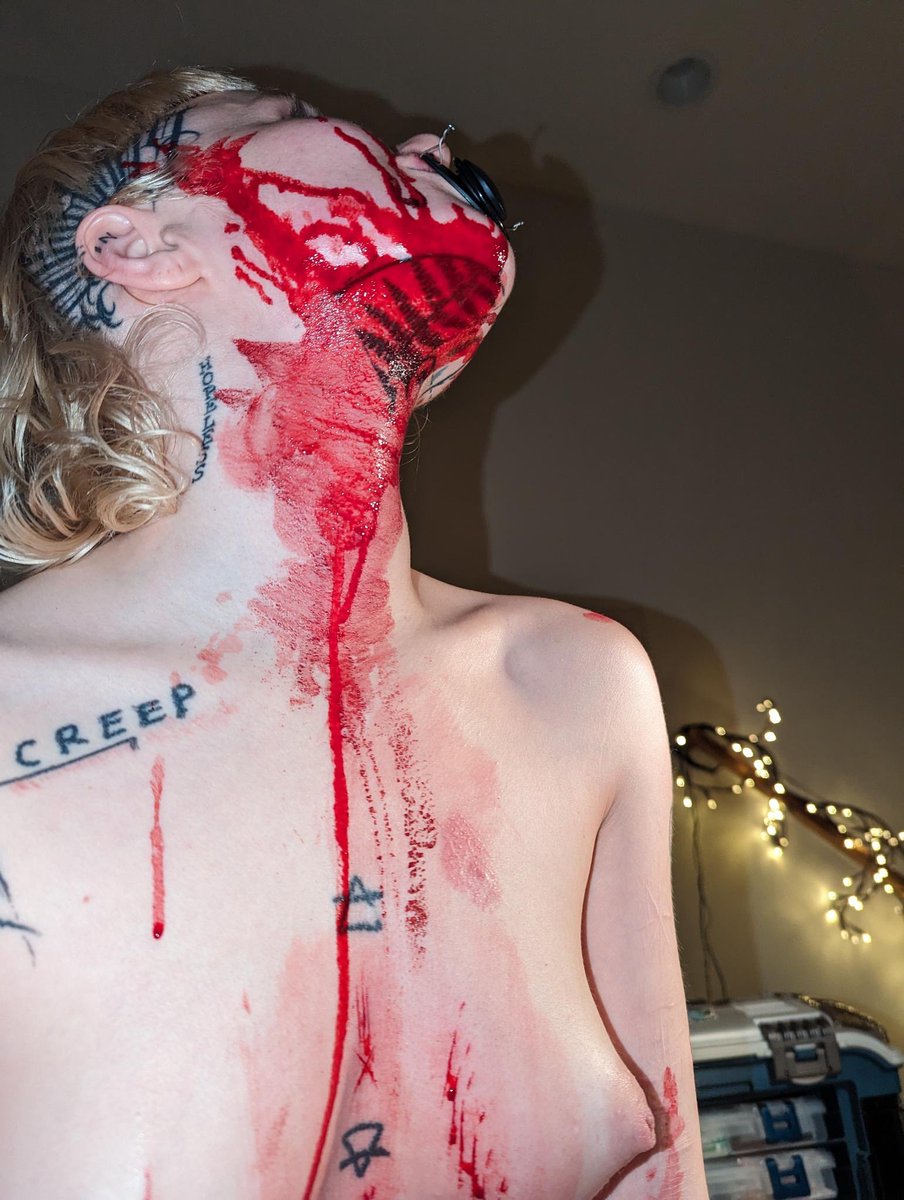 bruisecollector