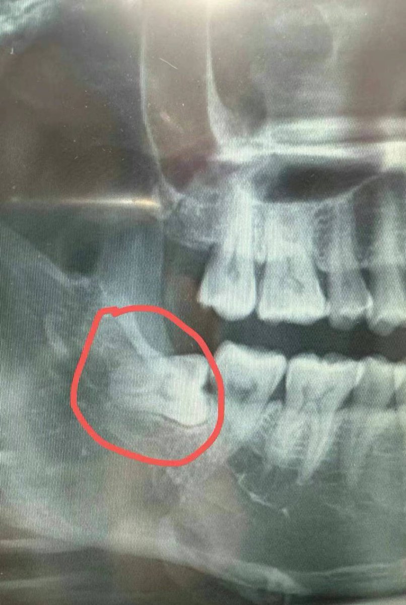Alcaredental tweet media