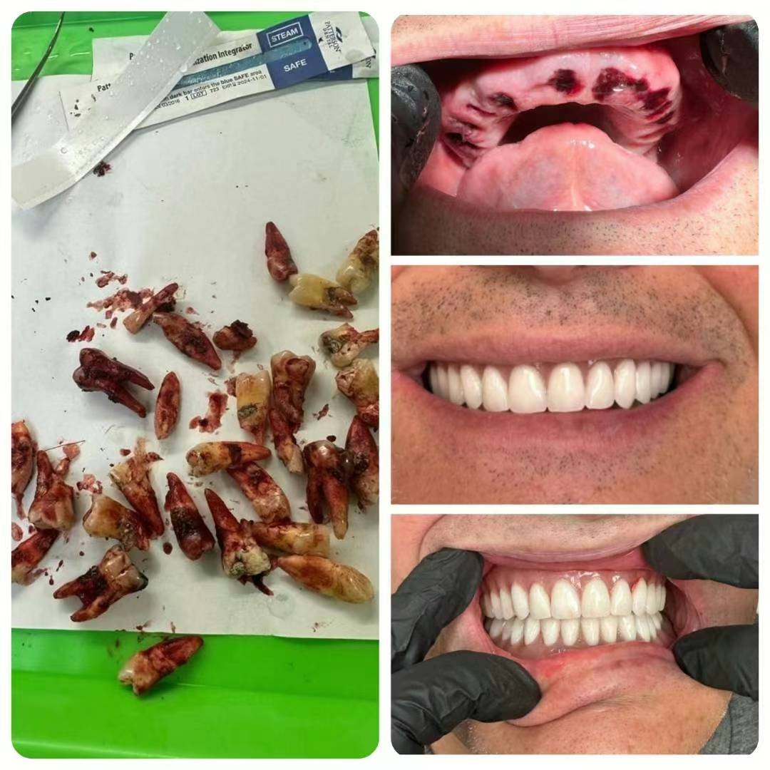 Alcaredental tweet media
