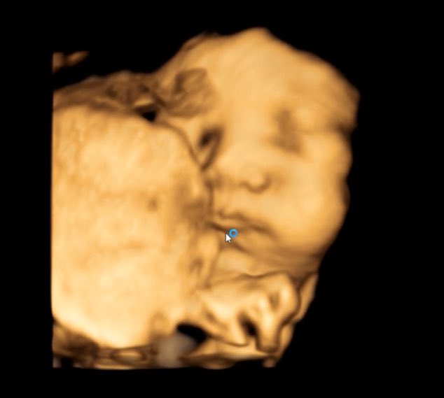 P82Tk's tweet photo. ぷっくりほっぺくんに会えるまであと1ヶ月切った👶
元気に会えますように🙏 https://t.co/Ty5irpHqGu