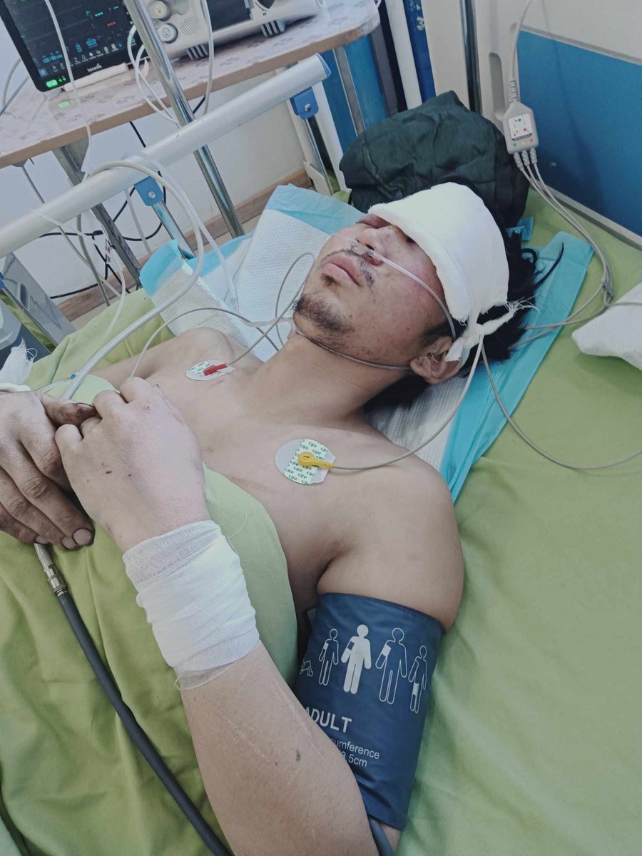 Маш яаралтай‼️‼️26-н настай 4-н хүүхдийн аав Гантулга гэх энэ залуугийн амь насыг яг одоо аврахыг ОБEГ, ГССҮТ-өөс гуйж байна‼️‼️‼️Гантулга нь Өчигдөр Өмнөговь аймгийн Ханбогд суманд том тэрэг жолоодож яваад осолд орж одоо Ханбогд сумын эмнэлэгт ухаангүй, духны ясны бяцарсан,