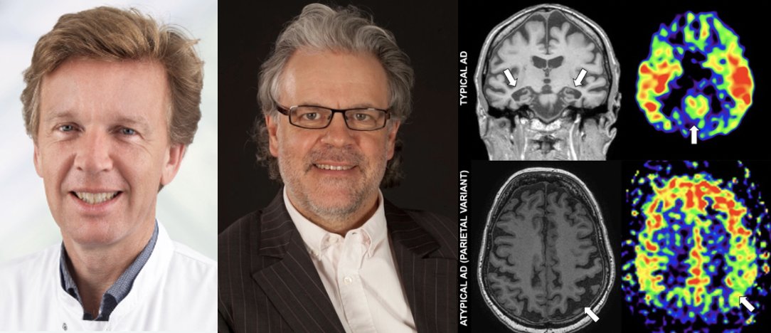 IDKD (@idkdcourse) on Twitter photo Interesting review about Neuroimaging in Dementia coauthored by Prof. Frederik Barkhof <a href="/FBarkhof/">Frederik Barkhof</a> from <a href="/amsterdamumc/">Amsterdam UMC</a> and Prof. Hans Rolf Jäger <a href="/ucl/">UCL</a>. We are happy to have them as part of our faculty at the IDKD 2024 in Davos! pubs.rsna.org/doi/10.1148/ra… <a href="/radiology_rsna/">Radiology</a> #IDKD2024 Interesting review about Neuroimaging in Dementia coauthored by Prof. Frederik Barkhof <a href="/FBarkhof/">Frederik Barkhof</a> from <a href="/amsterdamumc/">Amsterdam UMC</a> and Prof. Hans Rolf Jäger <a href="/ucl/">UCL</a>. We are happy to have them as part of our faculty at the IDKD 2024 in Davos! pubs.rsna.org/doi/10.1148/ra… <a href="/radiology_rsna/">Radiology</a> #IDKD2024