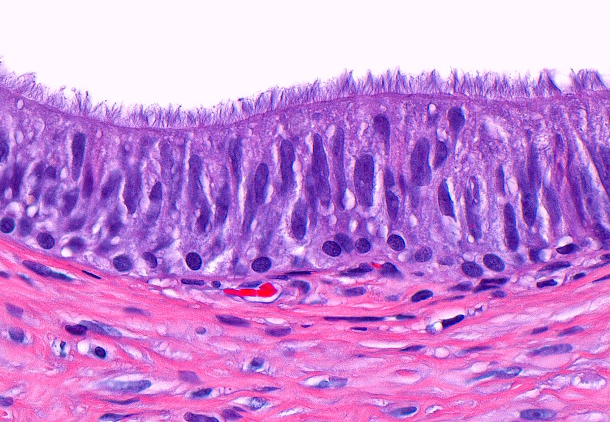 Vas Deferens Epithelium ~ #PathArt
