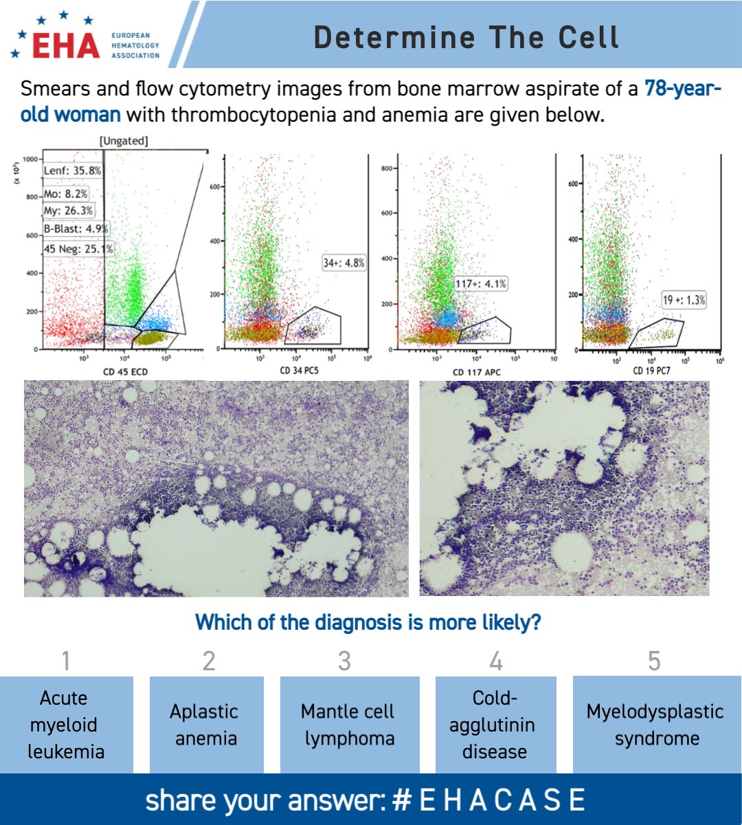 Welcome to the first #EHACase of 2024! Can you determine the patient’s diagnosis from the information given?

We'll return tomorrow with an explanation. This question is presented by Dr Umut Yilmaz. See you then!

How do you like our cases? Tell us here: wkf.ms/3Pdq1uw