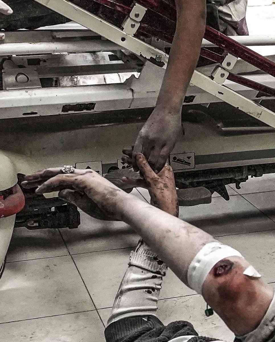 Sivillere karşı katliamlar devam ediyor, anne oğul birbirinin elini tutarak acılarını azaltmaya çalışıyorlar..