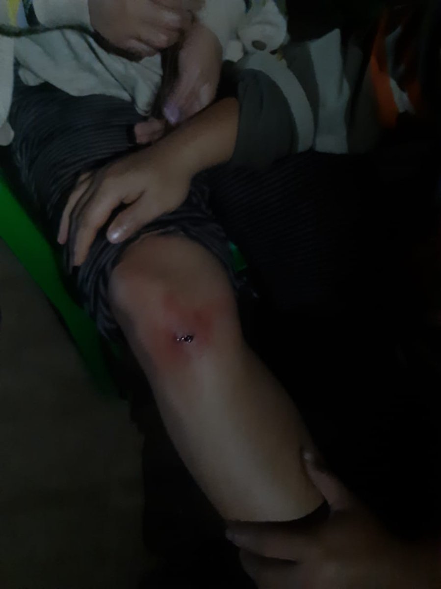 Mangginmisao's tweet photo. Meiteis freely commit #MeiteiAtrocities either as #MeiteiMilitant , #ArambaiTenggol or #ManipurPoliceCommandos to this day attacking people of all age or gender. Is this wat @PMOIndia @AmitShah really wants? If VoI wants peace #RemoveStateForcesFromMoreh who r the perpetrators https://t.co/DxpKtbWgMY