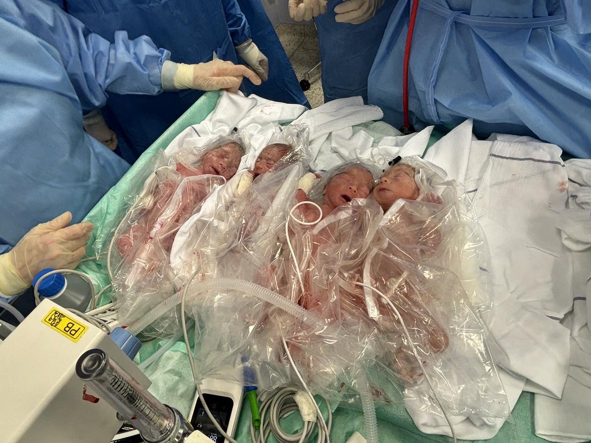 ukclj's tweet photo. Izjemna novica iz naše porodnišnice: rodili so se četverčki! Dečki Matej,Luka,Marko in Jovan so na svet prišli s CR v 31.tednu nosečnosti. Rojstvo četverčkov se zgodi na 500k porodov ali manj. Tu je šlo za spontano zanositev, kar je še toliko bolj redko. Iskrene čestitke družini! https://t.co/k6wsMgqO7n