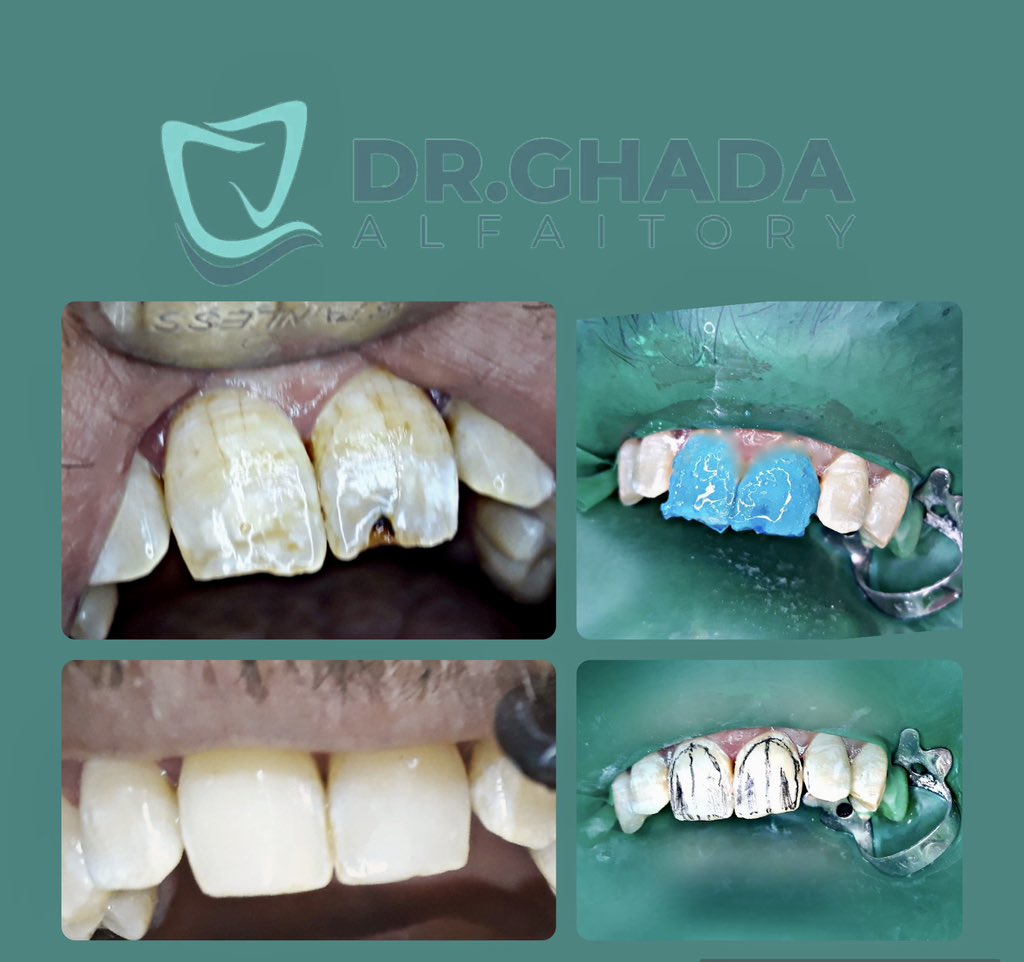 D.Ghada Alfaitory (@dentistdoshy) on Twitter photo 