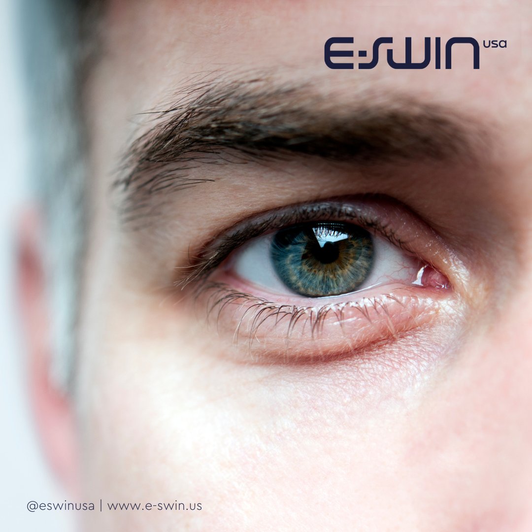 Every patient is unique, and so is their skin. E-Eye's advanced technology ensures effective treatment for Fitzpatrick Skin-types 1-5, providing comprehensive eye care for every patient.

Need more details about how E-Eye? Message us today!

#EswinUSA #EEye #PersonalizedEyeCare