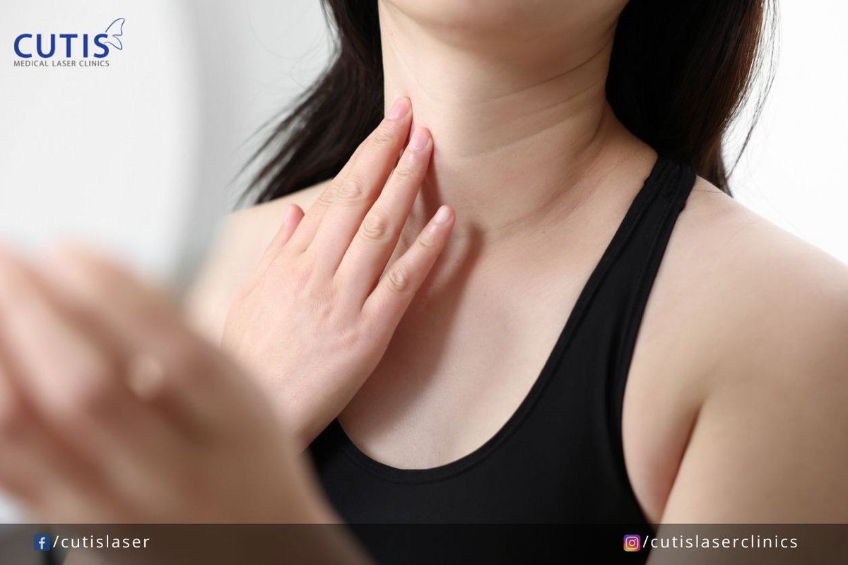 cutislaser's tweet image. Constant neglect of your neck can cause these signs of aging to appear sooner. Here are the common #signsofaging on the neck and what you can do to improve or address them. tinyurl.com/signsofagingon…

#FineLines #SaggingSkin #Wrinkles #BotulinumToxin #BroadSpectrumSunscreen