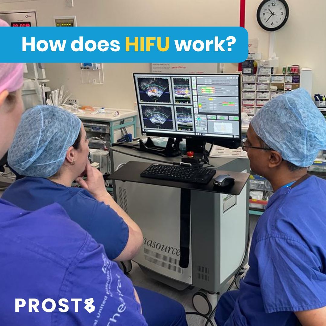 prost8uk's tweet photo. HIFU works by focusing ultrasound waves. It generates pinpoint heat targeting cancer cells, similar to a magnifying glass concentrating sunlight. This minimises damage to surrounding nerves, preserving urinary and sexual function.
#Prost8 #ProstateCancer #FocalTherapy #HIFU #NHS https://t.co/pLubSZBlUl