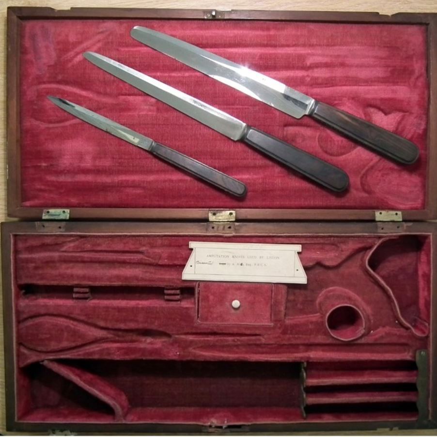 This case of amputation instruments was used by Robert Liston between 1815 and 1825 and was made by Stodart of London. The knives are of the type used for circular amputation.