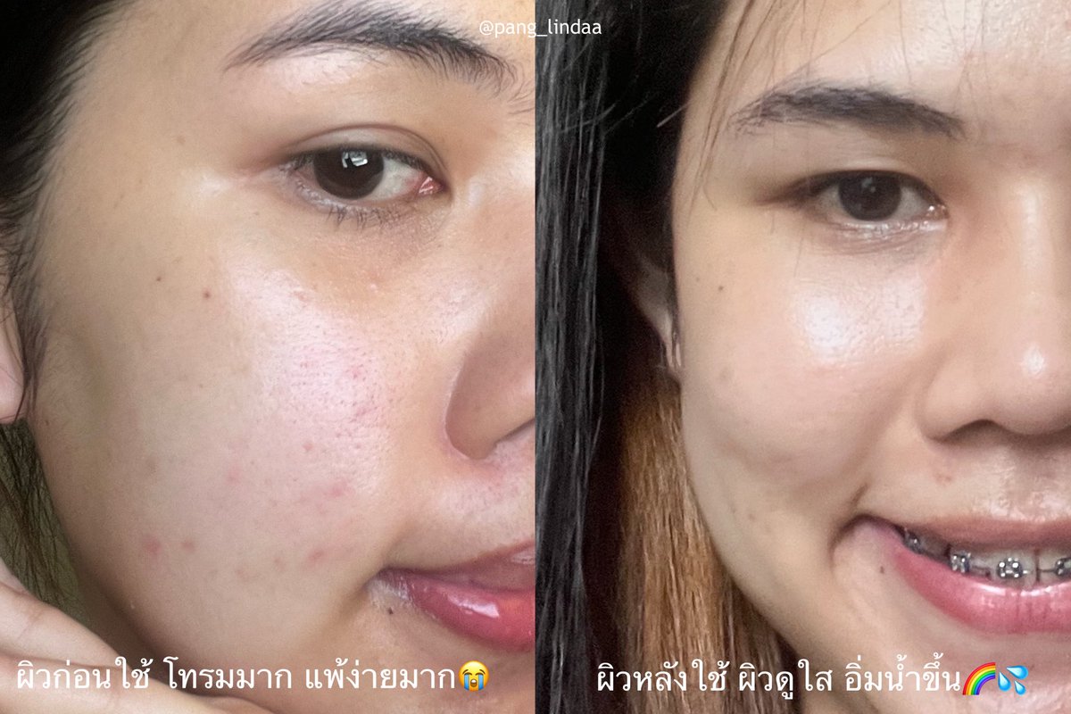 ลลินดา🎀 tweet media