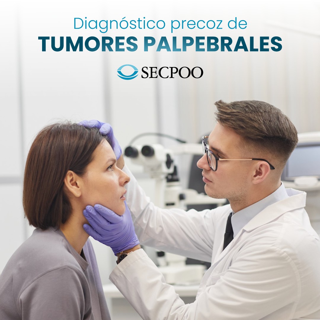 👉Uno de los  motivos de consulta más frecuentes en la consulta del cirujano oculoplástico son las lesiones o tumores palpebrales y perioculares. 

👩🏻‍⚕️👨🏻‍⚕️Resulta fundamental realizar un diagnóstico precoz y seguimiento adecuado por parte del oculoplástico.
