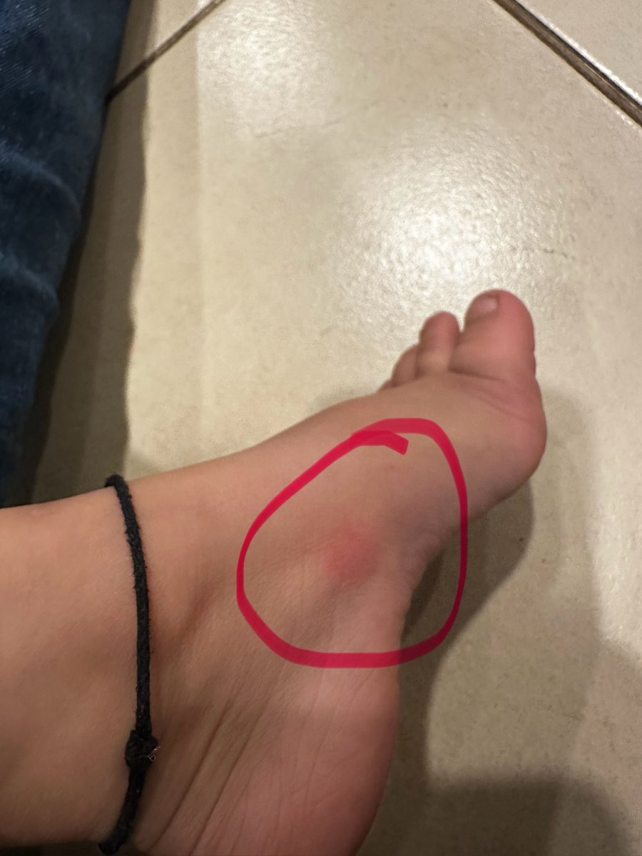 logeshjoshi's tweet photo. Bought #crocs for my 3 years old daughter and it wasn’t a good walk for her. @Crocs @CrocsIndia https://t.co/IgHHjpGvfX