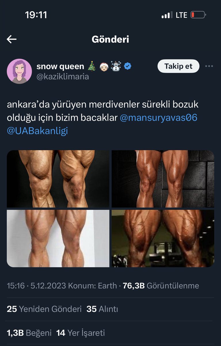 alpskomando's tweet photo. Mansür’ün yapmadığı metrolar yüzünden her yere yürüyerek gidince bizim bacaklar https://t.co/zAOjm7dvwh