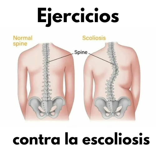 SenorMusculo's tweet photo. ¿Tienes escoliosis? ¿Conoces a alguien que la tenga? Estos ejercicios pueden ayudarte 🙌

Comparte este post para que tus amigos puedan ver este hilo tan útil 🔥 https://t.co/RRXR6UhOuw