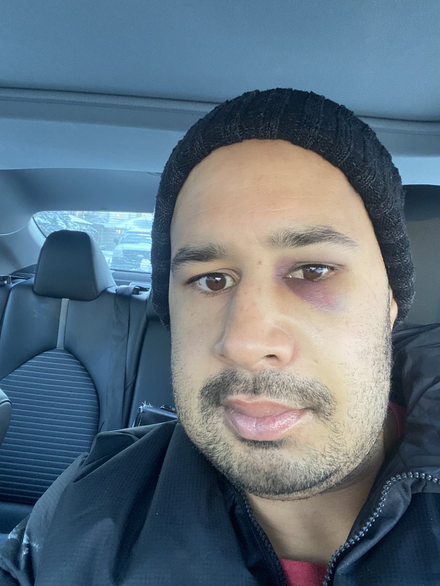 Eddie_Steele97's tweet photo. In this year of 2024 I now identify as Shrek ππ #WisdomTeethGone https://t.co/PZxEv767NY