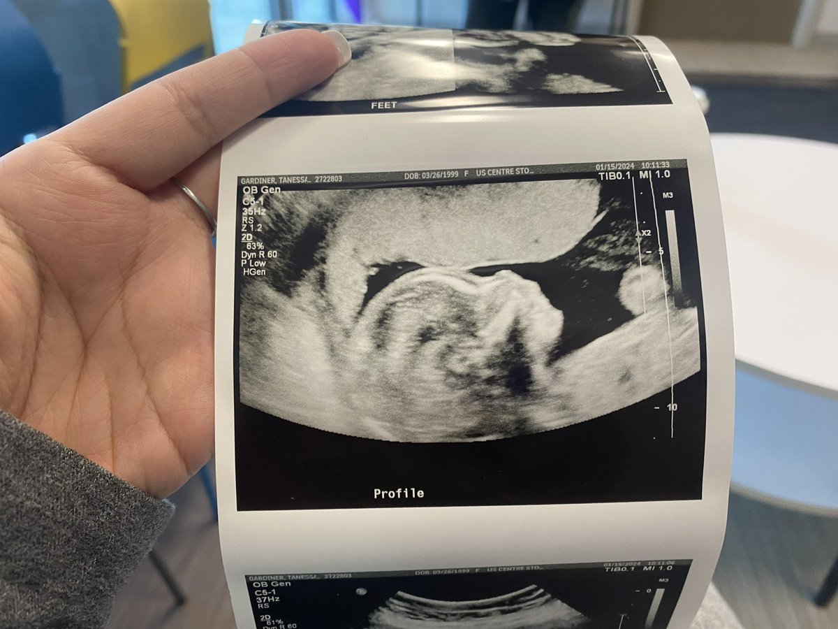 malto_98's tweet photo. My son is on the way.. ❤️🙏 https://t.co/oqi6ScHTXV