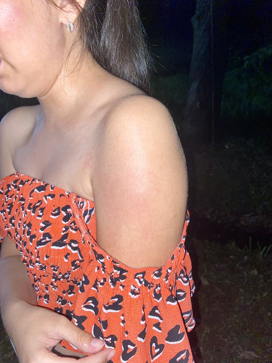 Mapazbelen's tweet photo. Estaba dudando en contar mi experiencia, pero japiro, cuando me miré al espejo y me vi con la cara amoretonada, recién me cayó la ficha de lo que me hicieron. No puedo creer que nadie nunca le expuso a Gisela Almada, ahora si con nombre, porque la denuncia ya está hecha. https://t.co/hUI8yXeIQg