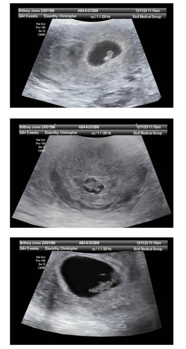 2024 I am not faking any more pregnancies. When I date a guy after a few months they start assuming I&rsquo;m<a href="/tag/uglygirlproblems"class="tags"><span>#uglygirlproblems</span></a>
